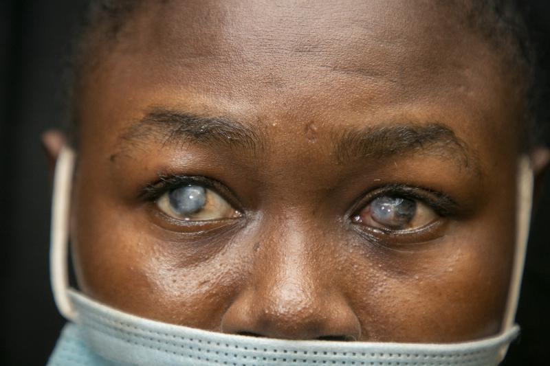 Glaucoma Management
