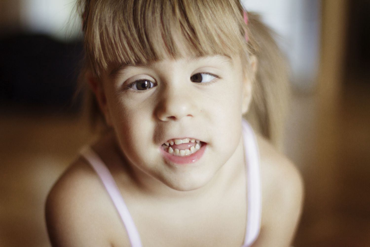 Strabismus (Squints) Treatment